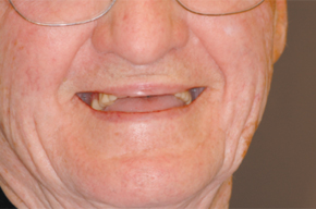 BA1a