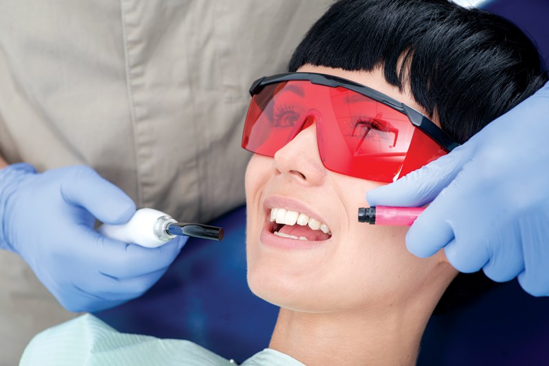 A Dentist applying Dental Sealants
