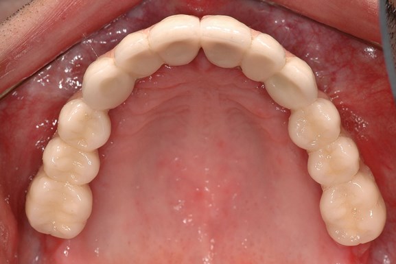 Case_2-Fig_4